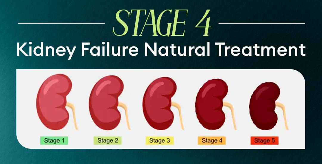 Stage 4 Kidney Failure Natural Treatment